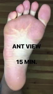 4811081