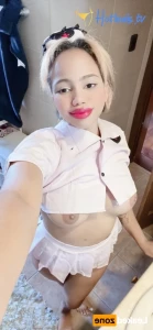 15592140