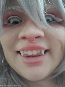 6230398