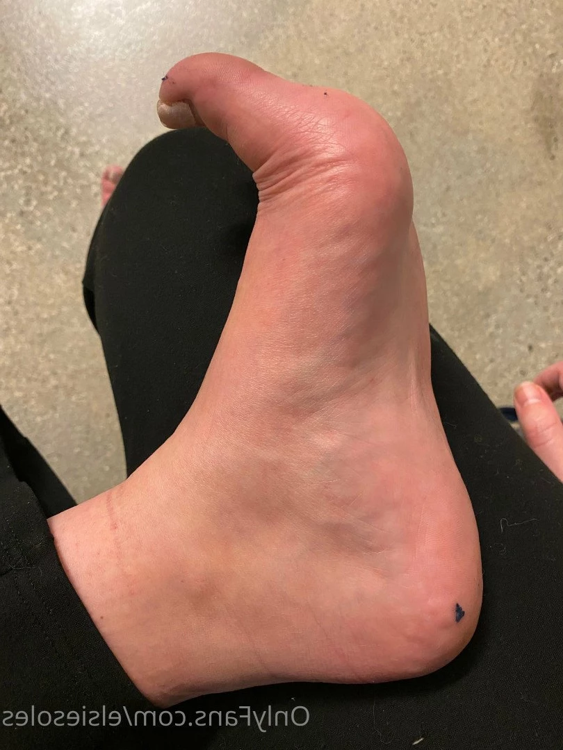 Elsie Soles [ elsiesoles ] Onlyfans leaked photo 3735797 on Hotleaks.tv
