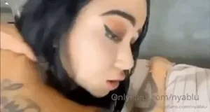 9151418