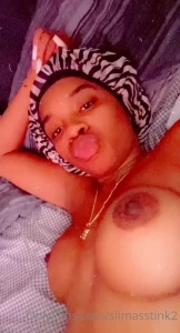 15809776