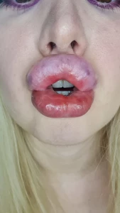 6178151