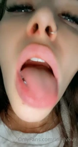 4849581