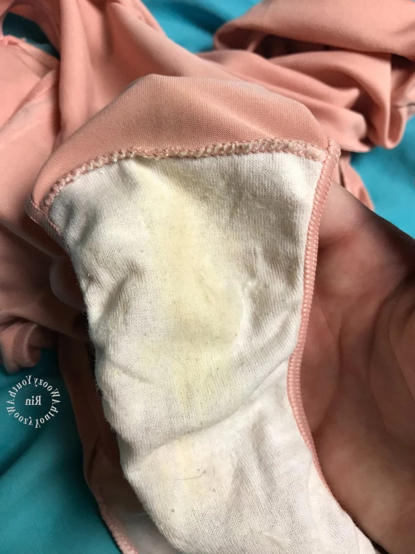 Rin ･ﾟ✧ [ awoozyyouth ] Onlyfans leaked photo 3829999 on Hotleaks.tv