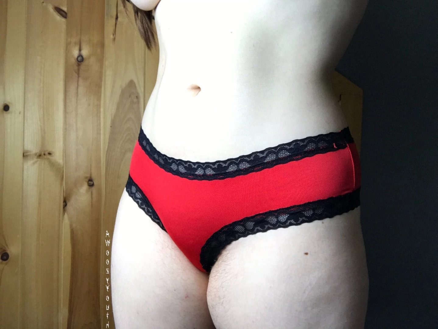 Rin ･ﾟ✧ [ awoozyyouth ] Onlyfans leaked photo 3876784 on Hotleaks.tv