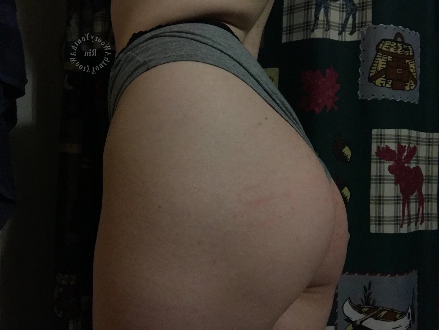 Rin ･ﾟ✧ [ awoozyyouth ] Onlyfans leaked photo 3877175 on Hotleaks.tv