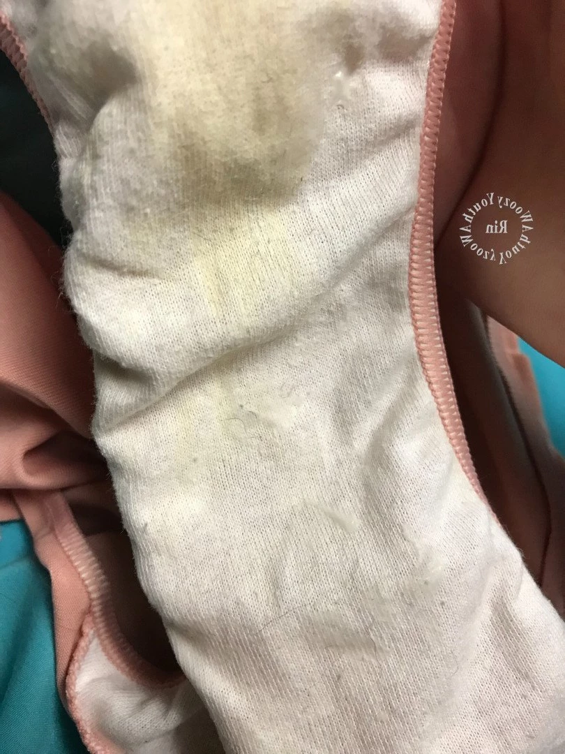 Rin ･ﾟ✧ [ awoozyyouth ] Onlyfans leaked photo 3891020 on Hotleaks.tv