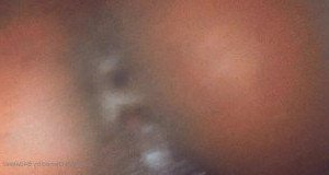 KiddieKat🍒💜 [ b4dakeez ] Onlyfans leaked video 3085527 on Hotleaks.tv