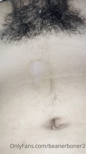 15517472