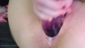 3152473