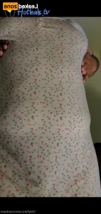 15483315