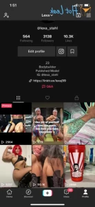15977912