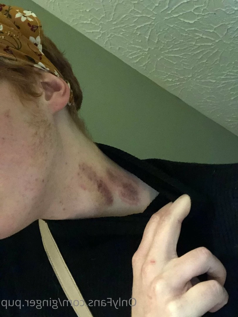 ginger.pup Onlyfans leaked photo 3186227 on Hotleaks.tv