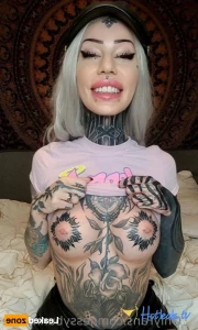 15382710