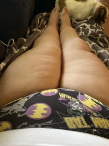 14782618