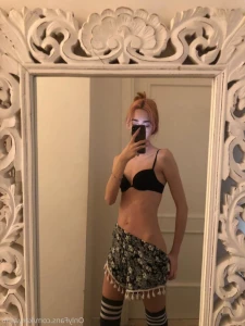 15620701