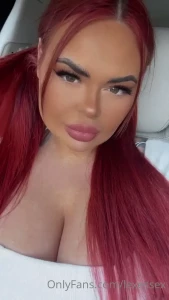 15866047