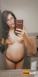 16255533