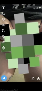 6294331