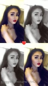 4276323