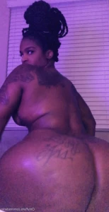 15903544