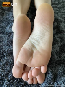 14180176