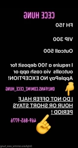 2872851