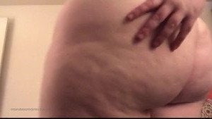 4517182