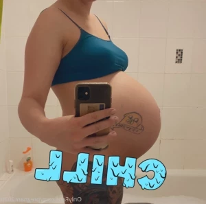 2844782