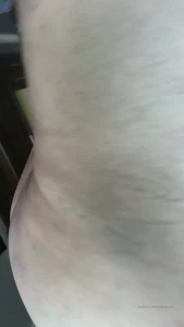15799020