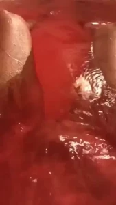 18278633