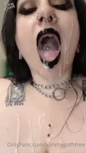 18276772