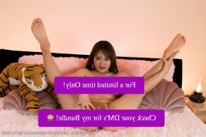 11388726