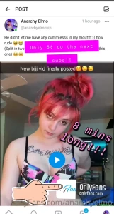 14476256