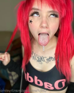 15525538