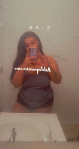 5795172