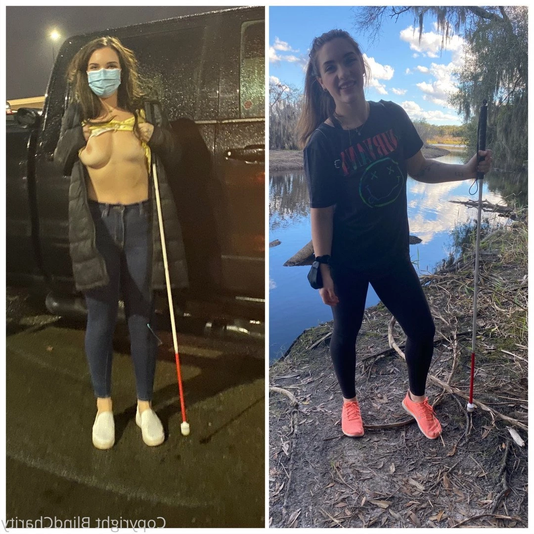 That one blind girl you know 👸🏻 [ blindcharity ] Onlyfans leaked photo 5230827 on Hotleaks.tv