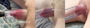 5869172