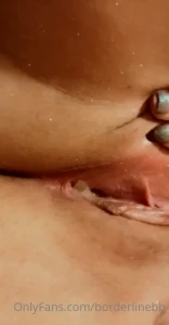 4995659