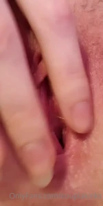 10579864