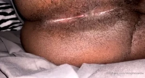 5007571