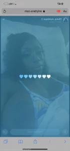16279224