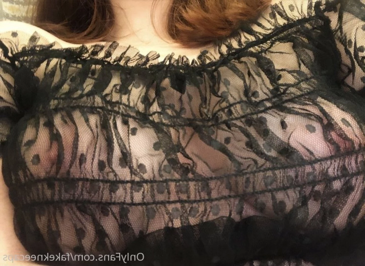 fakekneecaps Onlyfans leaked photo 5071632 on Hotleaks.tv