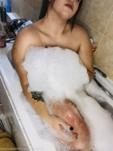 5581562