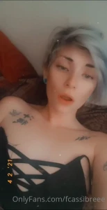 5035954