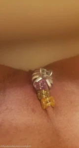 5570532