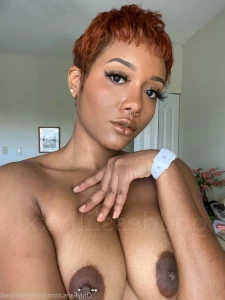 5593665