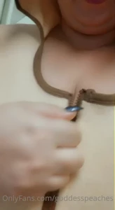 14158927
