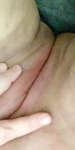 5764237
